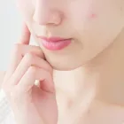 ニキビ跡