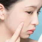 毛穴